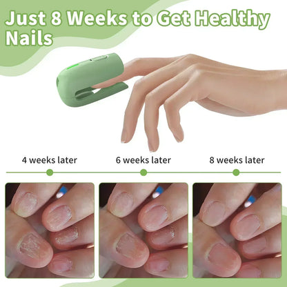 Nail Fungus Cleaning Device